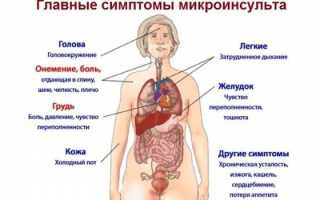 Основные симптомы инсульта у мужчин
