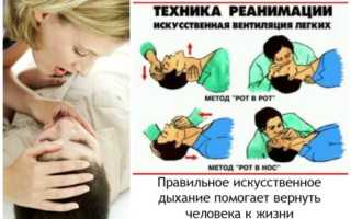 Что такое фибрилляция желудочков и лечение недуга