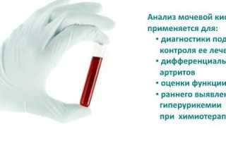 Подагра