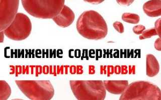 Почему понижаются эритроциты в крови: распространенные причины и способы коррекции показателей