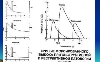 Фвд при бронхиальной астме расшифровка