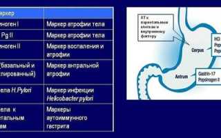 Расшифровка анализа «гастропанель»