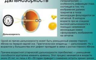 Дальнозоркость у детей