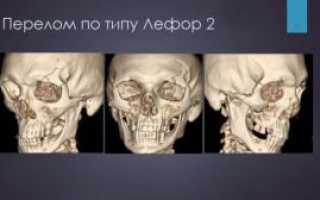 Сколько отростков с каждой стороны у верхней челюсти