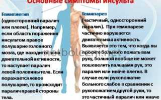 Геморрагический инсульт: левая сторона