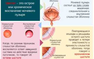 Питьевой режим при цистите у женщин