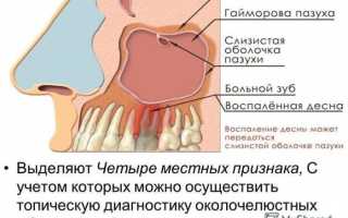 Боль в пазухах носа