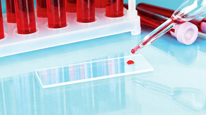 3 группа крови