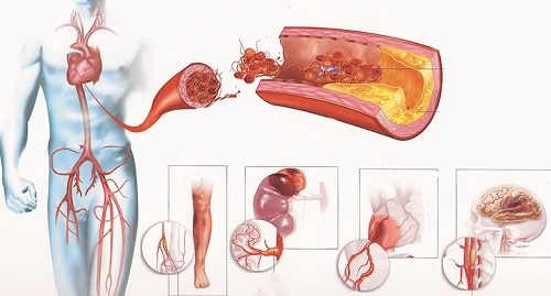 Травы от повышенного холестерина в крови и очищающие сосуды