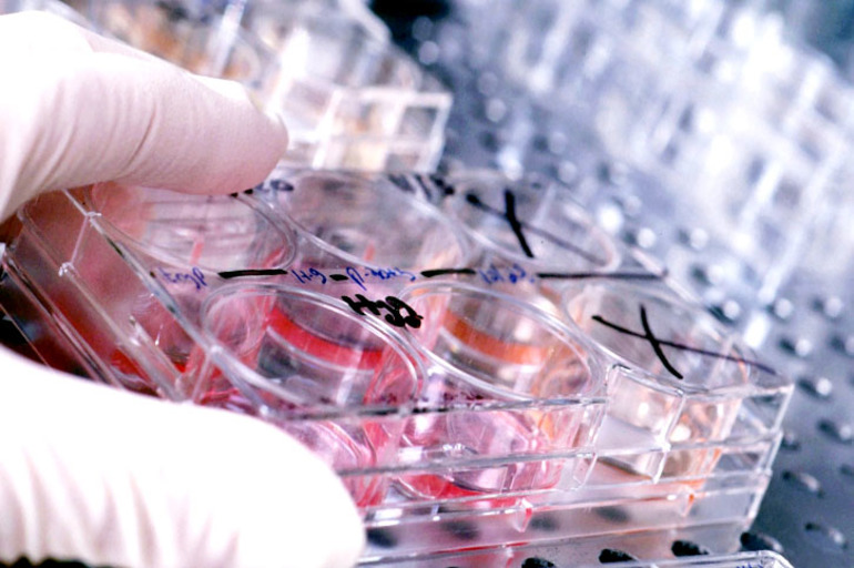 АФП анализ крови