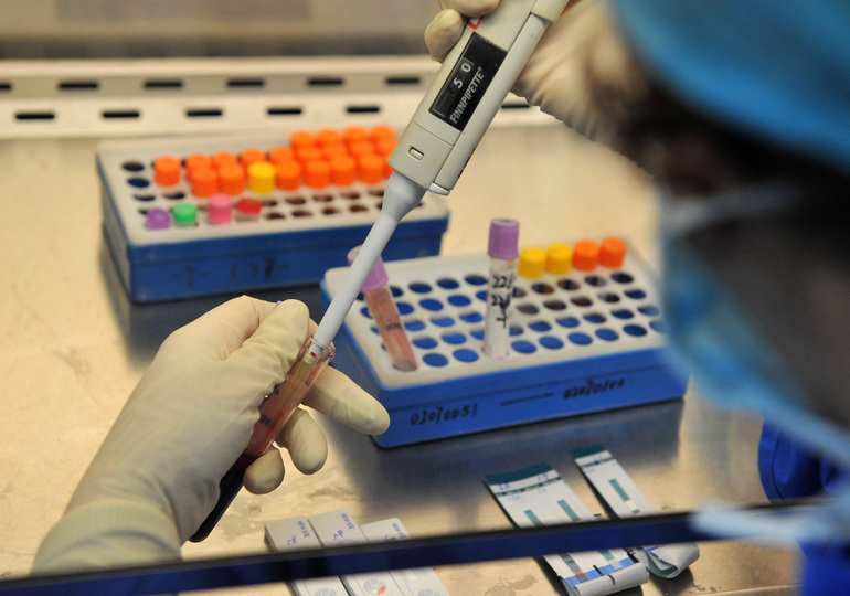 Активность аспартатаминотрансферазы