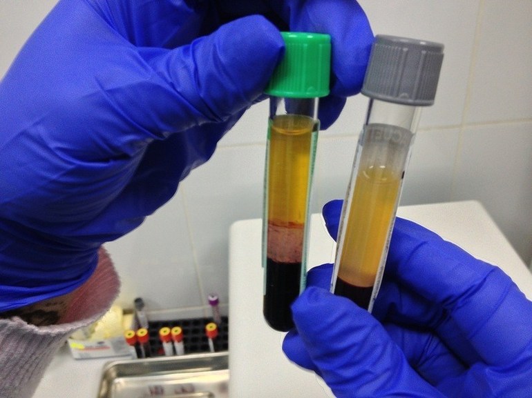 Анализ плазмы