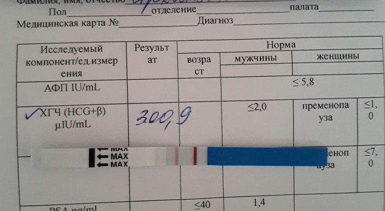 Анализ ХГЧ при беременности