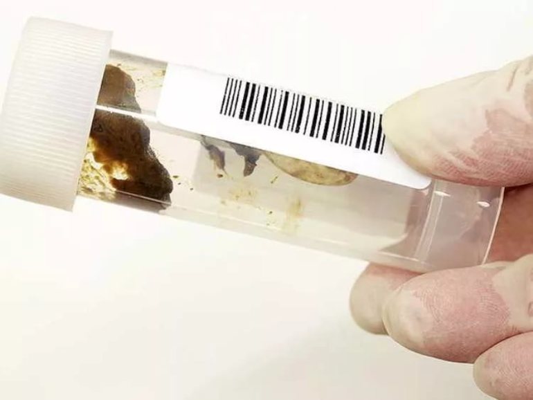 Анализ кала ребенка