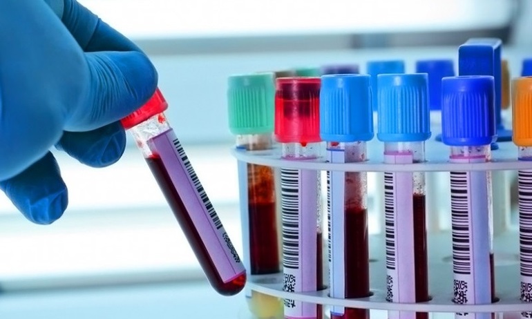 Анализ крови