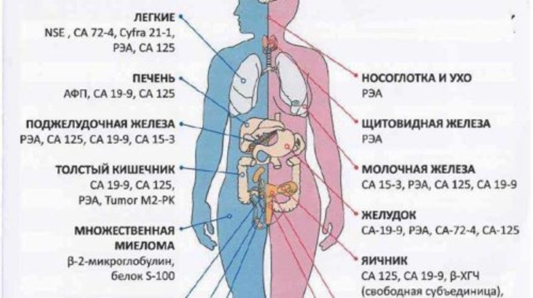 Анализ крови, онкомаркер норма у женщин