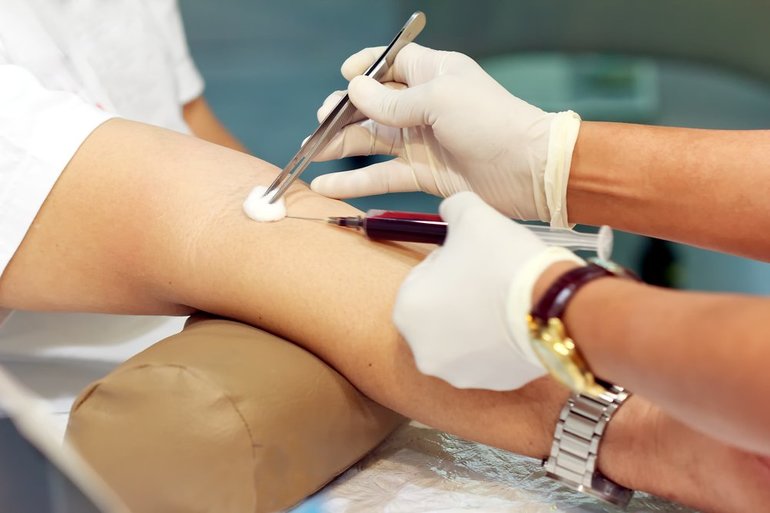 Анализ на МНО