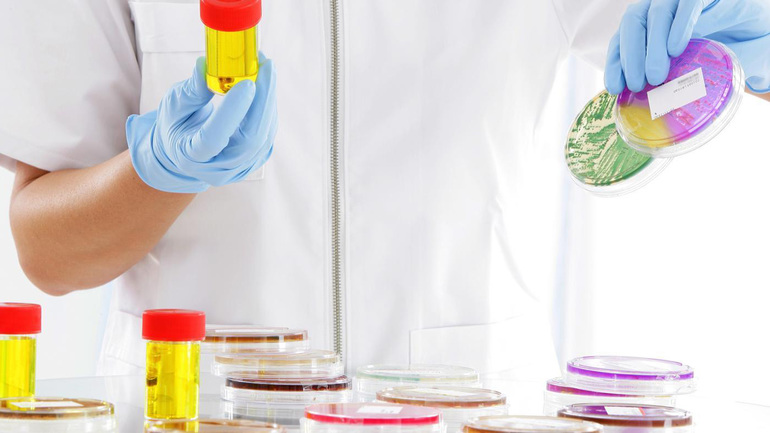 Анализ мочи