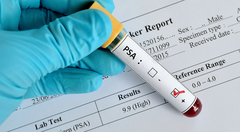 Анализ пса у мужчин расшифровка