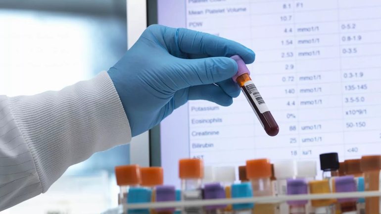 Анализ т4 свободный