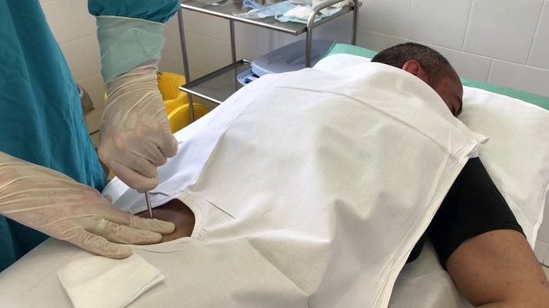 Анализ трепанобиопсия