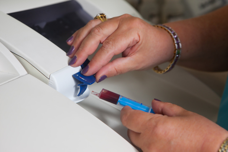 Анализ на тромбокрит