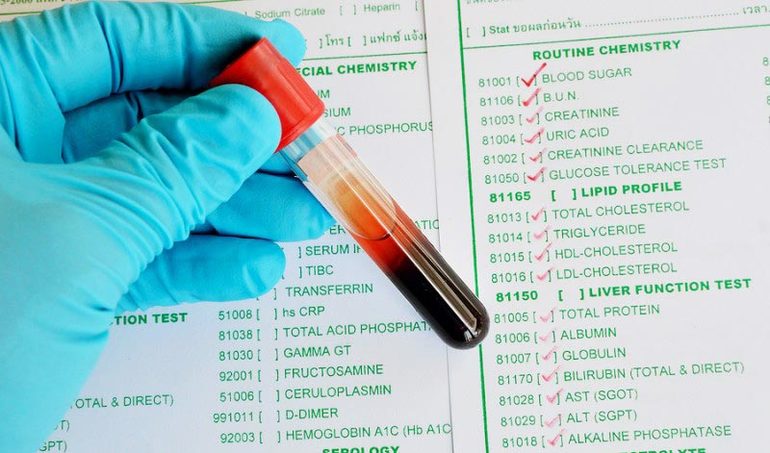 Анализ на уровень холестерина