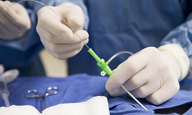 Методика проведения ангиографии