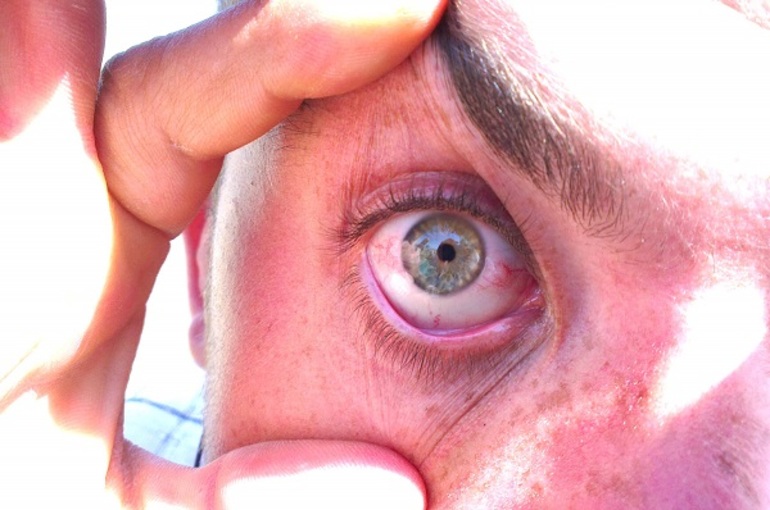 ангиопатия глаз