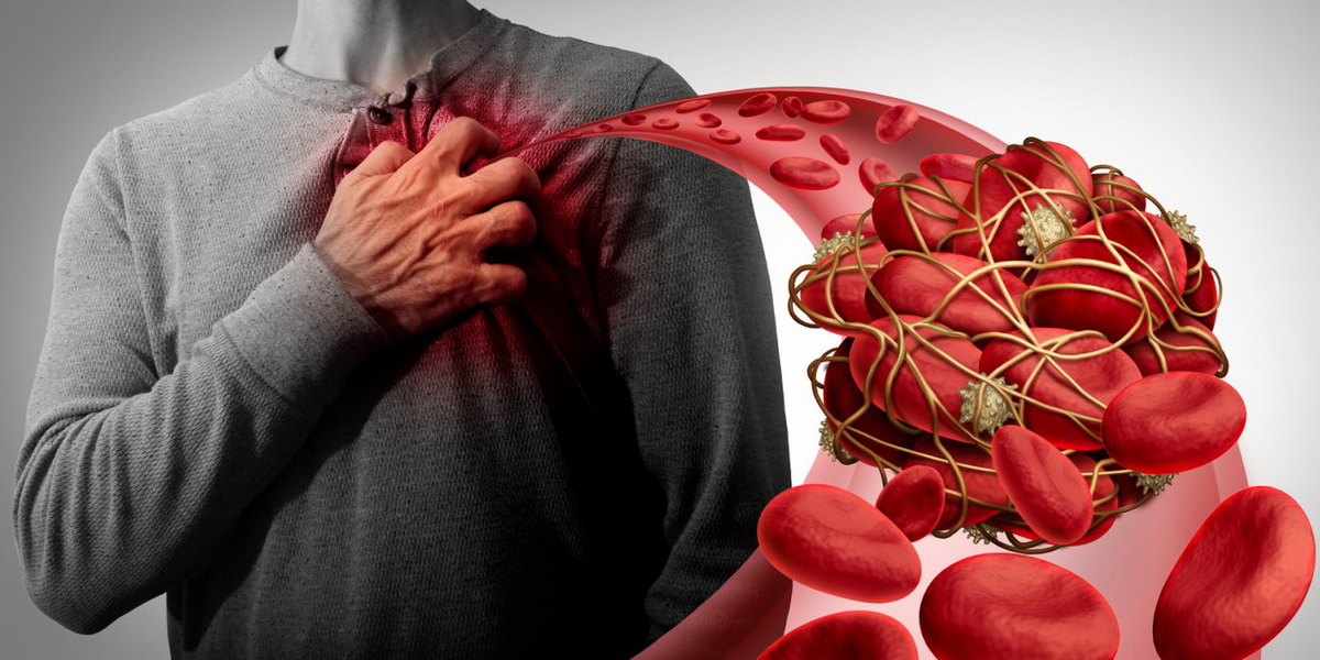 антикоагулянты