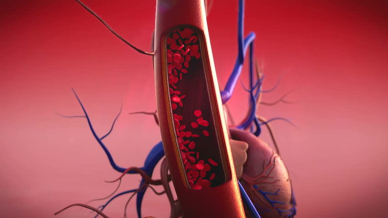 Артериальное кровотечение, признаки и причины