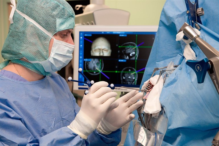 Атеросклероз сосудов головного мозга