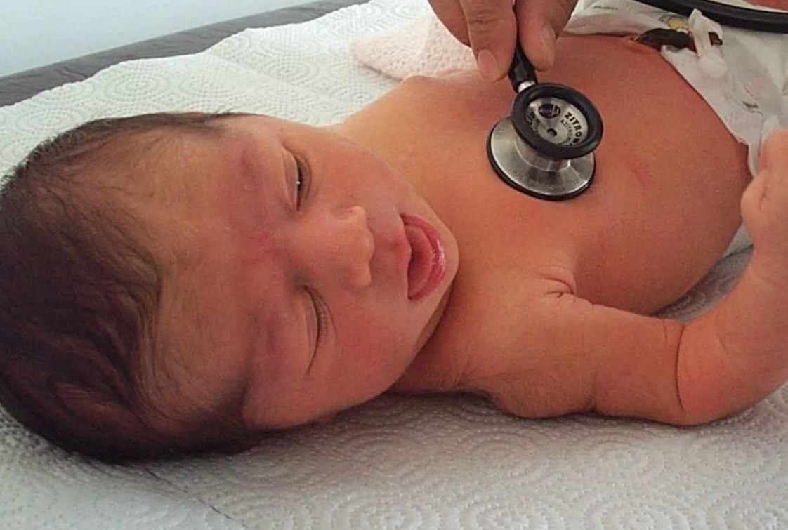 Критический билирубин у новорожденного