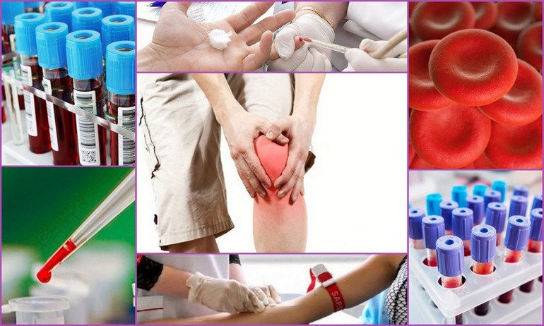 Биохимический анализ расшифровк