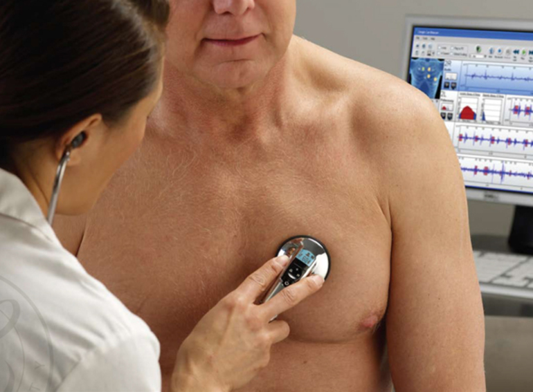 Брадикардия сердца причины