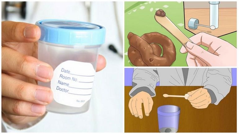 Как брать анализ кала