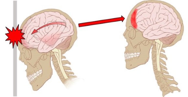 Черепно-мозговые травмы разной степени тяжести