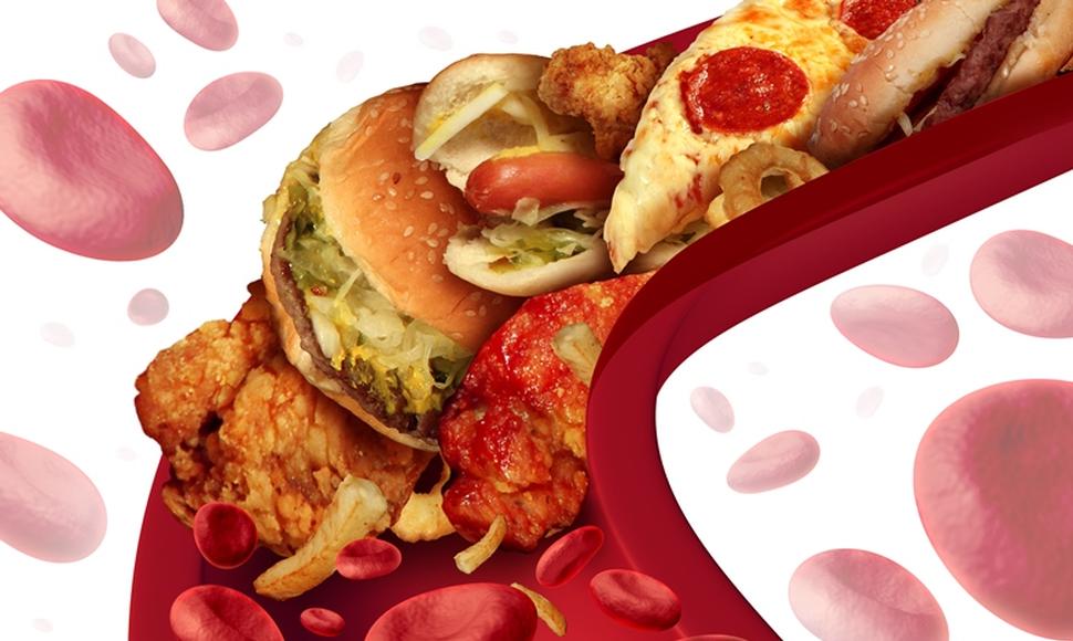 продукты с высоким содержанием холестерина