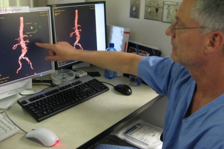 Диагностика атеросклероза сосудов