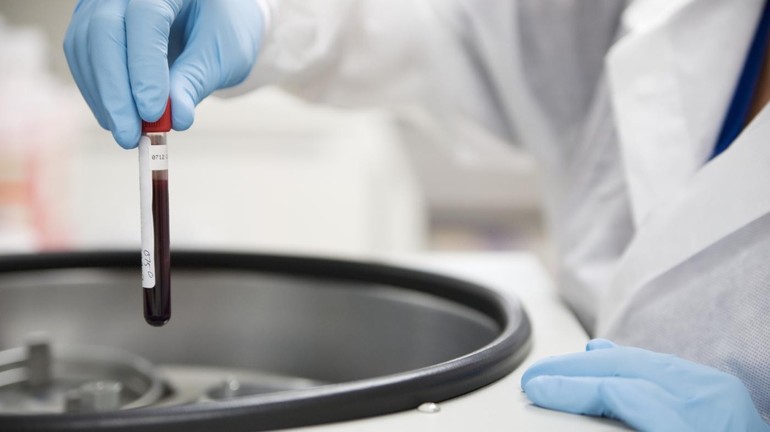 Диагностика заболевания гемофилия