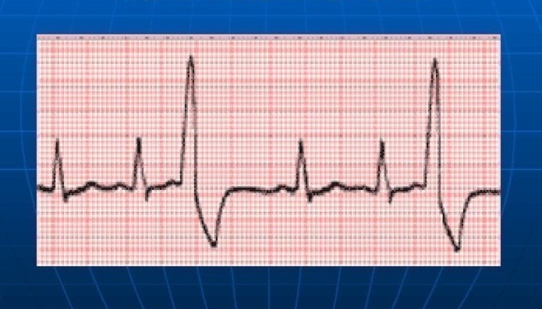 Как диагностируется