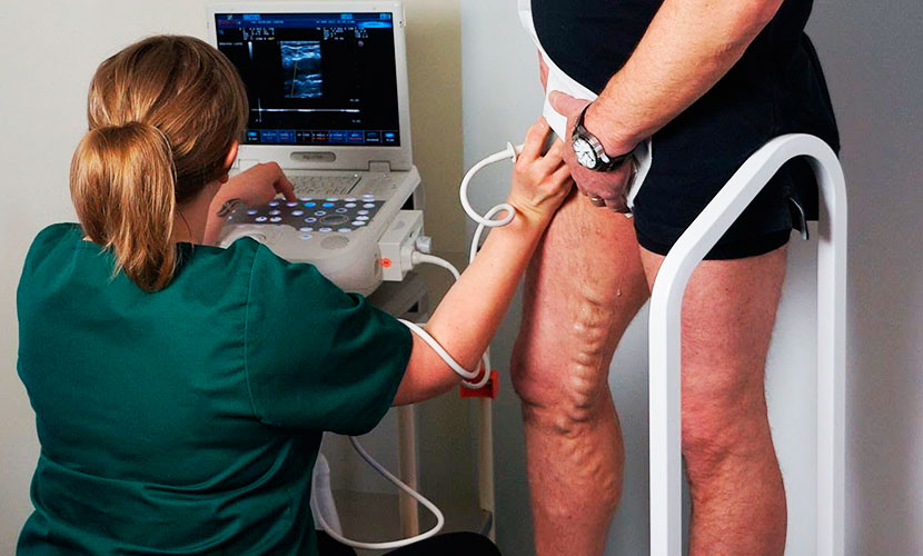 дуплексное сканирование сосудов