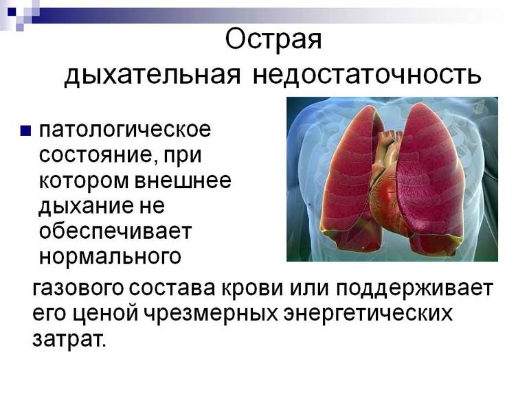 Дыхательная недостаточность