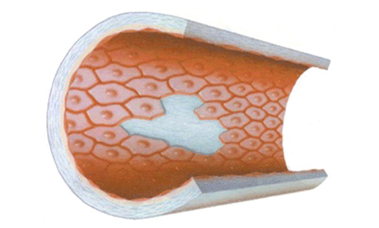 Эндотелиальные клетки