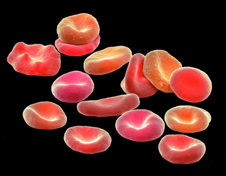 эритроциты выше нормы