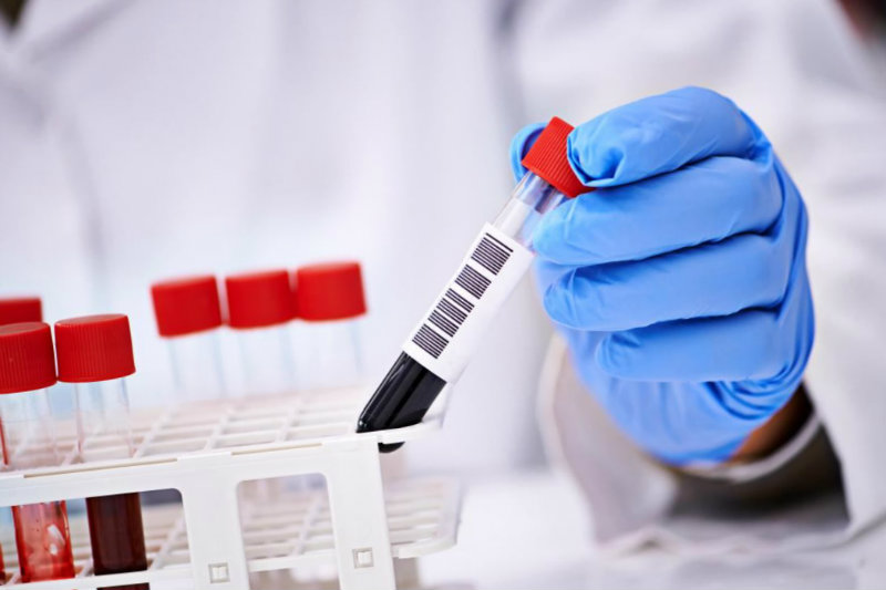 анализ крови