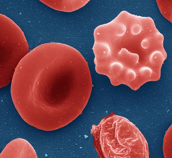 клетки, отличающиеся от стандартной формы