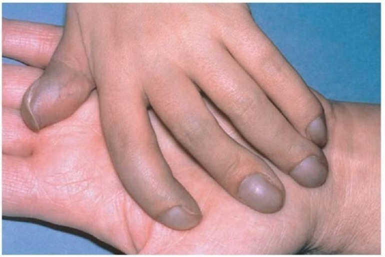 Этапы операции