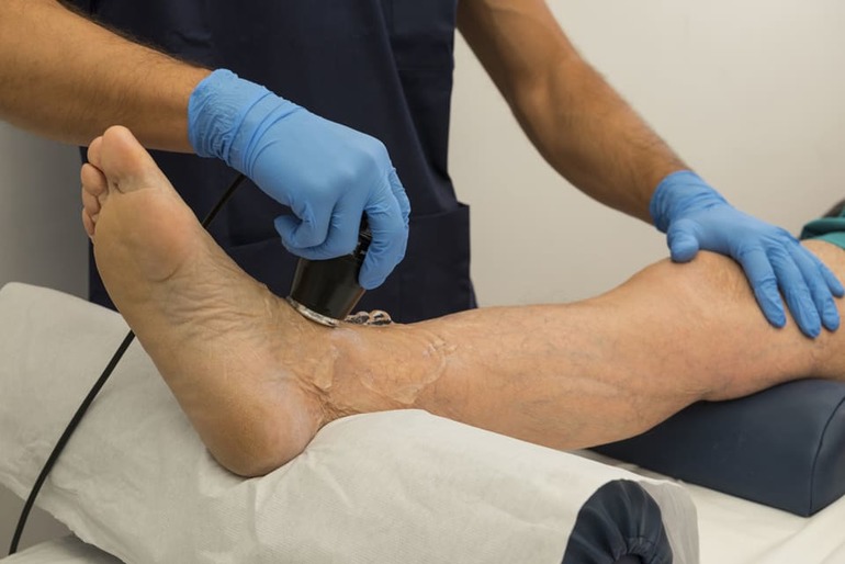 Физиотерапия тромбофлебита вен нижних конечностей