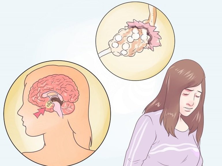 фсг норма у женщин